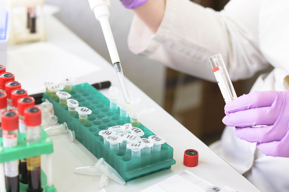 urine drug test